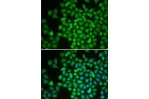 Immunofluorescence (IF) image for anti-COP9 Constitutive Photomorphogenic Homolog Subunit 5 (Arabidopsis) (COPS5) (AA 1-334) antibody (ABIN6218868) (COPS5 antibody  (AA 1-334))