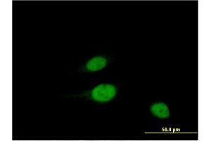 Immunofluorescence of monoclonal antibody to WBSCR22 on HeLa cell. (WBSCR22 antibody  (AA 1-110))