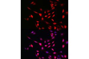 Immunofluorescence analysis of NIH/3T3 cells using UFM1 Rabbit pAb (ABIN7271184) at dilution of 1:150 (40x lens). (UFM1 antibody  (AA 1-85))