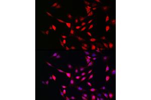 Immunofluorescence analysis of NIH/3T3 cells using UFM1 Rabbit pAb (ABIN7271184) at dilution of 1:150 (40x lens). (UFM1 antibody  (AA 1-85))