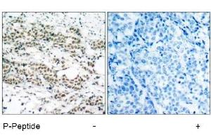 Image no. 1 for anti-Forkhead Box O4 (FOXO4) (pSer197) antibody (ABIN196850) (FOXO4 antibody  (pSer197))