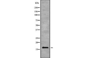 Western blot analysis of BTF3L4 using HT29 whole cell lysates (BTF3L4 antibody  (Internal Region))