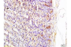 Formalin-fixed and paraffin embedded rat stomach tissue labeled with Anti-Somatostatin/GRIH Polyclonal Antibody, Unconjugated at 1:200 followed by conjugation to the secondary antibody and DAB staining (Somatostatin antibody  (AA 103-116))