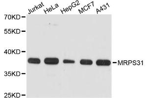 Western blot analysis of extracts of various cell lines, using MRPS31 antibody. (MRPS31 antibody)