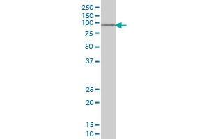 SOX13 monoclonal antibody (M01), clone 3E8 Western Blot analysis of SOX13 expression in Jurkat . (SOX13 antibody  (AA 25-138))