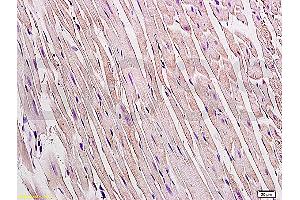 Formalin-fixed and paraffin embedded rat heart tissue labeled Anti-Connexin 43 Polyclonal Antibody, Unconjugated (ABIN671451) at 1:200, followed by conjugation to the secondary antibody and DAB staining (Connexin 43/GJA1 antibody  (AA 211-260))