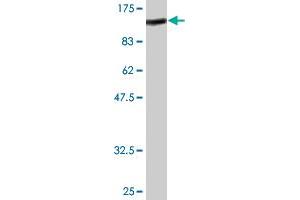 Western Blot detection against Immunogen (89. (Radixin antibody  (AA 1-583))