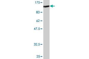 Western Blot detection against Immunogen (89. (Radixin antibody  (AA 1-583))