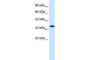 WB Suggested Anti-ZNF2 Antibody Titration:  1. (ZNF2 antibody  (N-Term))