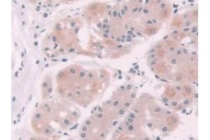 Immunohistochemistry (IHC) image for anti-NAD(P)H Dehydrogenase, Quinone 1 (NQO1) (AA 2-274) antibody (ABIN7430126)