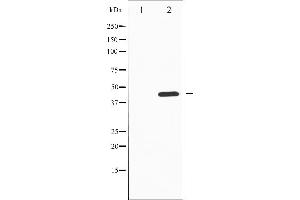 Western blot analysis of Tyrosine Hydroxylase phosphorylation expression in PC12 whole cell lysates,The lane on the left is treated with the antigen-specific peptide. (Tyrosine Hydroxylase antibody  (pSer19))