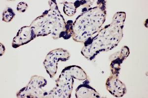 Anti-TLR7 antibody, IHC(P) IHC(P): Human Placenta Tissue (TLR7 antibody  (C-Term))