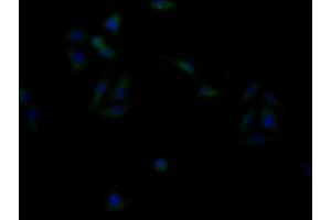 Immunofluorescence staining of HepG2 cells with ABIN7153367 at 1:133, counter-stained with DAPI. (GPRC6A antibody  (AA 403-581))