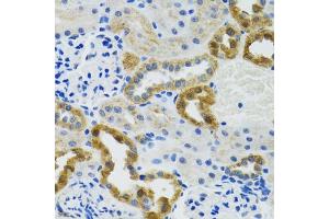 Immunohistochemistry of paraffin-embedded mouse kidney using POLG2 antibody (ABIN6132502, ABIN6145894, ABIN6145895 and ABIN6222405) at dilution of 1:100 (40x lens). (POLG2 antibody  (AA 216-485))