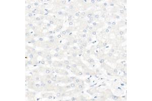 Immunohistochemistry of paraffin-embedded Human liver using CD20 antibody (ABIN7268472) at dilution of 1:100 (40x lens).