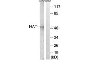 Western blot analysis of extracts from K562 cells, using HAT Antibody. (HAT antibody  (AA 331-380))