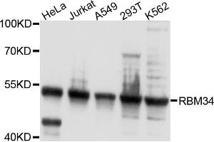 Western blot analysis of extracts of various cell lines, using RBM34 antibody. (RBM34 antibody)