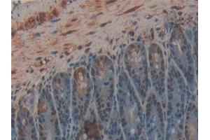 IHC-P analysis of Mouse Intestine Tissue, with DAB staining.