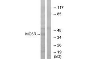 Western blot analysis of extracts from K562 cells, using MC5R Antibody. (MC5 Receptor antibody  (AA 271-320))