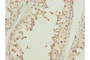 Immunohistochemistry of paraffin-embedded human testis tissue using ABIN7143059 at dilution of 1:100 (Actl7b antibody  (AA 1-415))