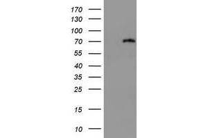 Image no. 1 for anti-DEAD (Asp-Glu-Ala-Asp) Box Polypeptide 59 (DDX59) (AA 1-303) antibody (ABIN1490733) (DDX59 antibody  (AA 1-303))
