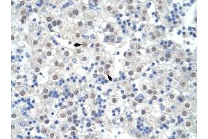 Immunohistochemistry (IHC) image for anti-Splicing Factor 3b, Subunit 1, 155kDa (SF3B1) (Middle Region) antibody (ABIN629905)