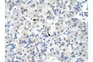 SF3B1 antibody was used for immunohistochemistry at a concentration of 4-8 ug/ml to stain Hepatocytes (arrows) in Human Liver.