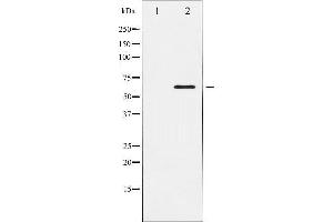 Western Blotting (WB) image for anti-ELK1, Member of ETS Oncogene Family (ELK1) antibody (ABIN1846330) (ELK1 antibody)