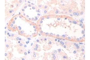 Immunohistochemistry (IHC) image for anti-Leukemia Inhibitory Factor Receptor alpha (LIFR) (AA 692-833) antibody (ABIN7437986)