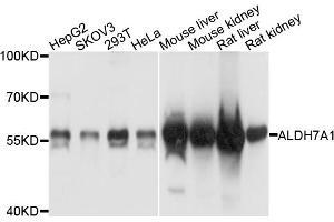 Western blot analysis of extracts of various cell lines, using ALDH7A1 antibody. (ALDH7A1 antibody)