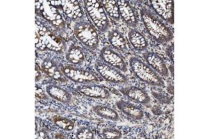 IHC analysis of TJP2/ZO2 using anti-TJP2/ZO2 antibody (ABIN7602800). (TJP2 antibody  (C-Term))