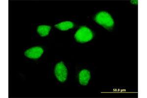 Immunofluorescence of purified MaxPab antibody to MEF2D on HeLa cell. (MEF2D antibody  (AA 1-521))