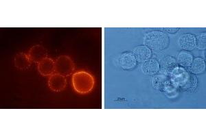 Expression of Bombesin receptor 2 in human HT-29 cells - Cell surface detection of BB2 receptor in live intact human HT-29 (colorectal adenocarcinoma) cells. (GRPR antibody  (3rd Extracellular Loop))
