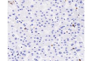 Immunohistochemistry analysis of paraffin-embedded human liver using MPO Polyclonal Antibody at dilution of 1:300. (Myeloperoxidase antibody)