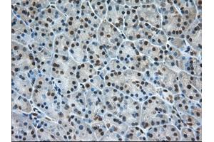 Immunohistochemical staining of paraffin-embedded Human Kidney tissue using anti-ERCC1 mouse monoclonal antibody.