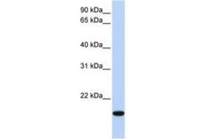 Image no. 1 for anti-Homeobox even-skipped homolog protein 2 (EVX2) (AA 154-203) antibody (ABIN6744266) (EVX2 antibody  (AA 154-203))