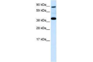 WB Suggested Anti-SERPINF1 Antibody Titration:  0.