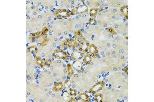 Immunohistochemistry of paraffin-embedded mouse kidney using PHPT1 antibody (ABIN5970475) at dilution of 1/100 (40x lens). (PHPT1 antibody)