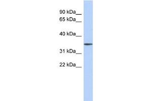 WB Suggested Anti-FBXO31 Antibody Titration: 0. (FBXO31 antibody  (Middle Region))
