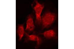 ABIN6274398 staining Hela by IF/ICC. (STEAP4 antibody  (C-Term))