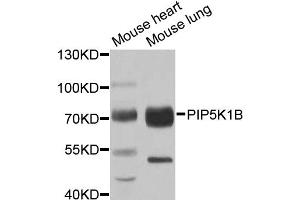 Western blot analysis of extracts of various cell lines, using PIP5K1B antibody (ABIN5974763) at 1/1000 dilution.