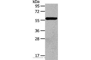 Western blot analysis of Hela cell, using HDAC7 Polyclonal Antibody at dilution of 1:100 (HDAC7 antibody)