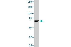 TBX3 monoclonal antibody (M02), clone 8H3. (TBX3 antibody  (AA 311-410))