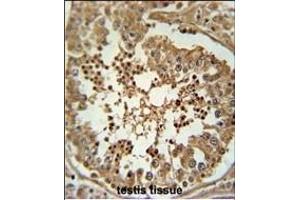 C Antibody (Center) (ABIN653885 and ABIN2843132) immunohistochemistry analysis in formalin fixed and paraffin embedded human testis tissue followed by peroxidase conjugation of the secondary antibody and DAB staining. (C3orf58 antibody  (AA 159-188))