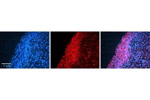 Immunohistochemistry (IHC) image for anti-Matrix Metalloproteinase 2 (MMP2) (C-Term) antibody (ABIN2792308)