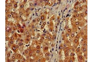 Immunohistochemistry of paraffin-embedded human liver tissue using ABIN7159786 at dilution of 1:100 (LC3C antibody  (AA 1-30))