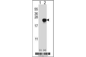 Western blot analysis of ARL2 using rabbit polyclonal ARL2 Antibody (D170) using 293 cell lysates (2 ug/lane) either nontransfected (Lane 1) or transiently transfected (Lane 2) with the ARL2 gene. (ARL2 antibody  (C-Term))