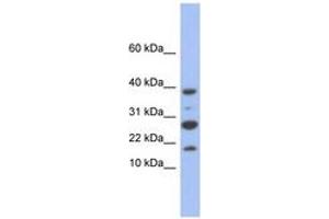 NDUFC1 antibody  (C-Term)