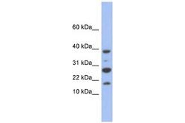NDUFC1 antibody  (C-Term)