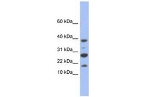 Image no. 1 for anti-NADH Dehydrogenase (Ubiquinone) 1, Subcomplex Unknown, 1, 6kDa (NDUFC1) (C-Term) antibody (ABIN6744061)